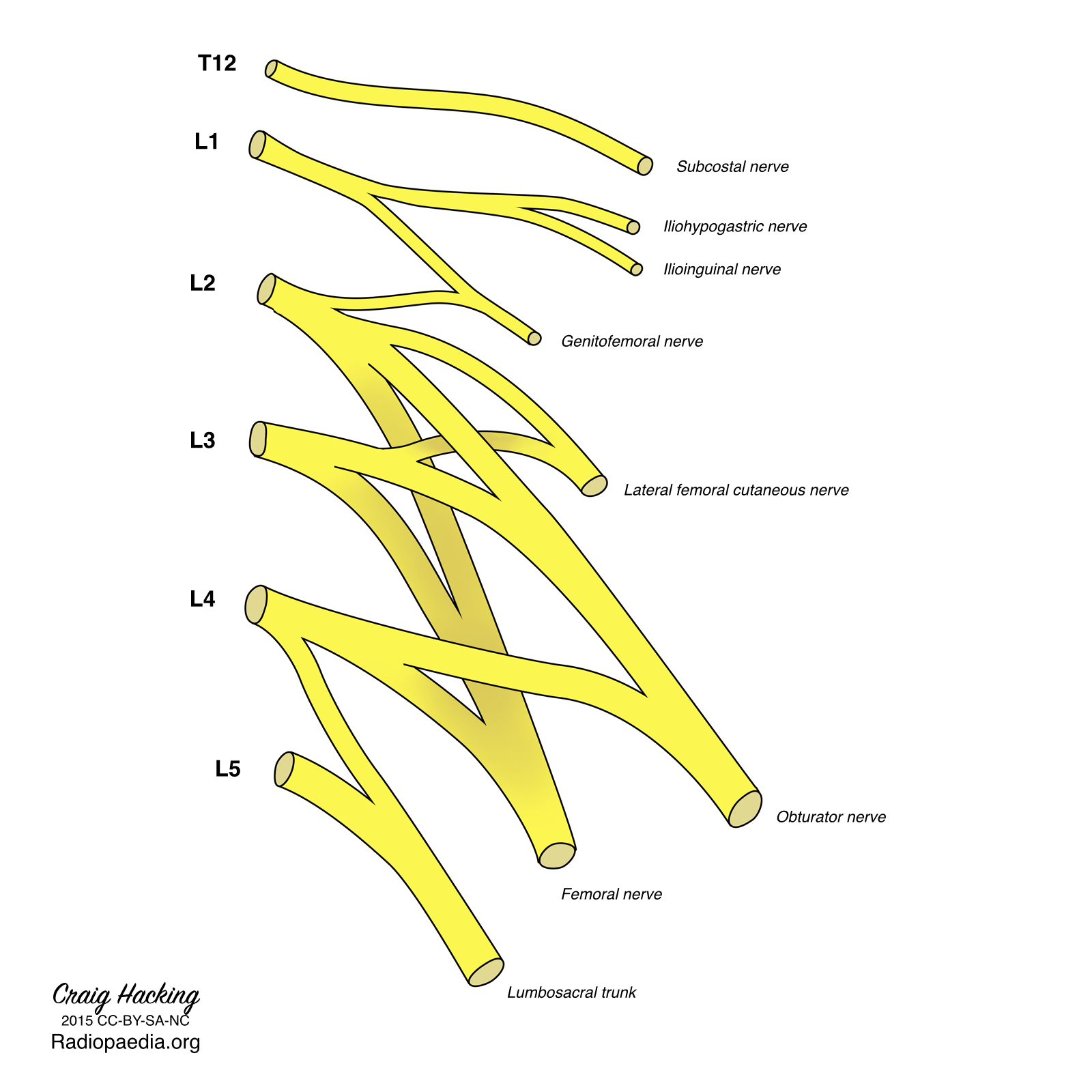 Radiopaedia Drawing Lumbar plexus English labels AnatomyTOOL